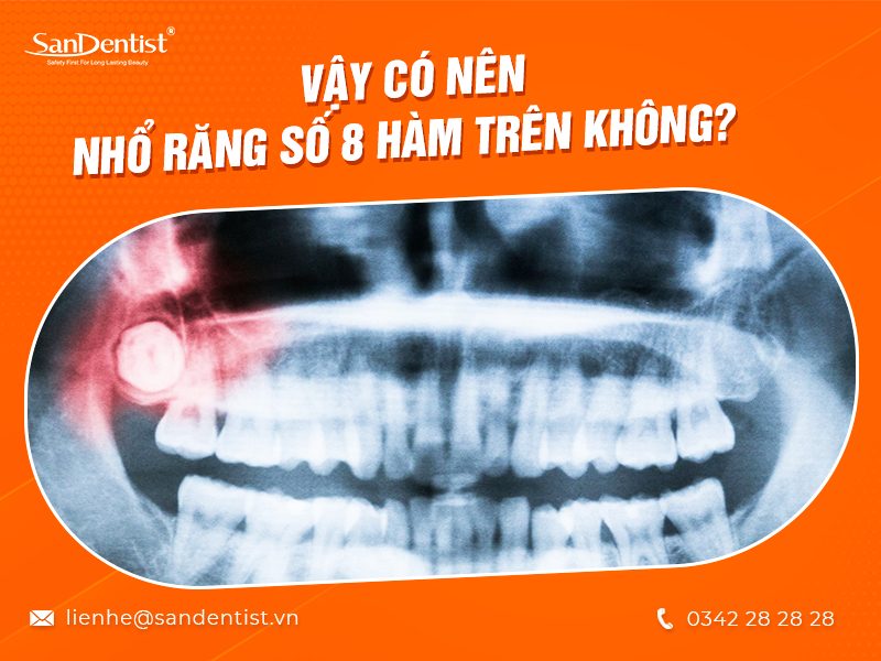 Có nên nhổ răng số 8 hàm trên không? Liệu có nguy hiểm không?