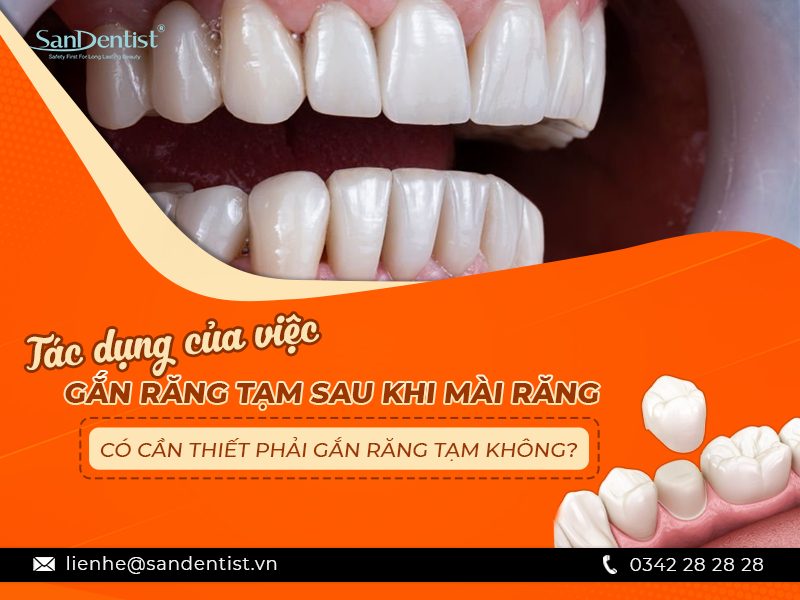 Gắn răng tạm sau khi mài răng có cần thiết không?