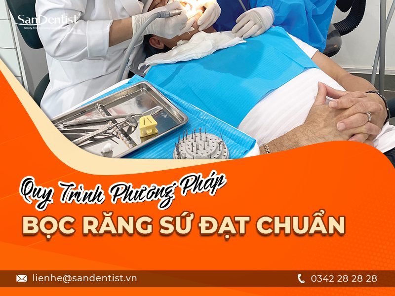 Phương pháp bọc sứ răng khểnh và những lợi ích mang lại