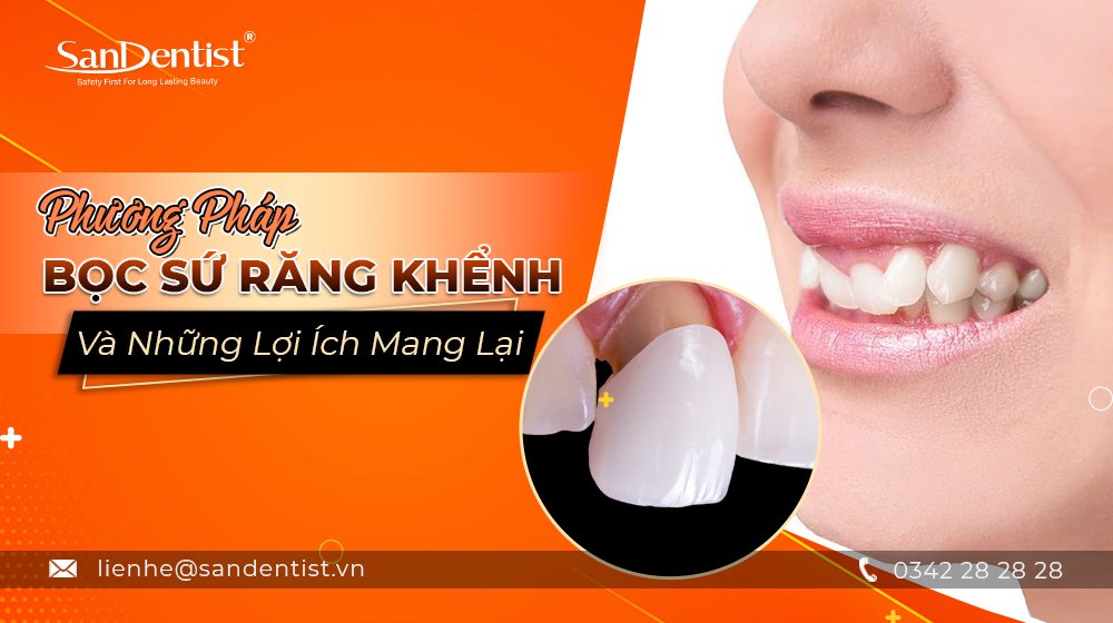 Răng sứ khểnh nhô ra phía trước có ảnh hưởng đến thẩm mỹ khuôn mặt không?
