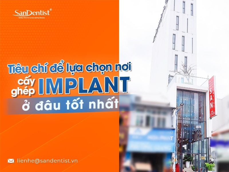 Địa chỉ cấy ghép implant ở đâu tốt nhất và chất lượng tại TPHCM?