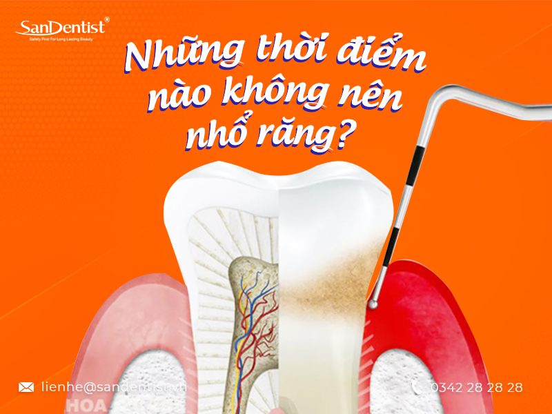 Theo bạn nên nhổ răng vào lúc nào là thích hợp?