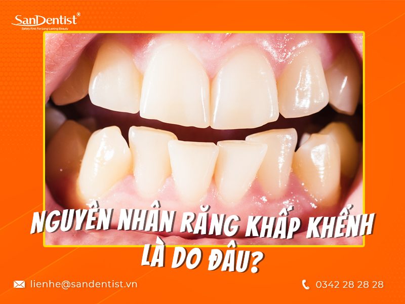 Răng khấp khểnh phải làm sao để hồi phục nhanh chóng