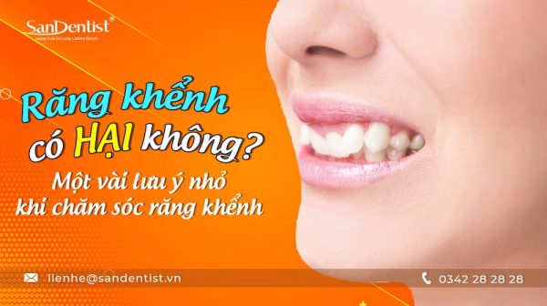 Răng khểnh có hại không? Một vài lưu ý nhỏ khi chăm sóc răng khểnh