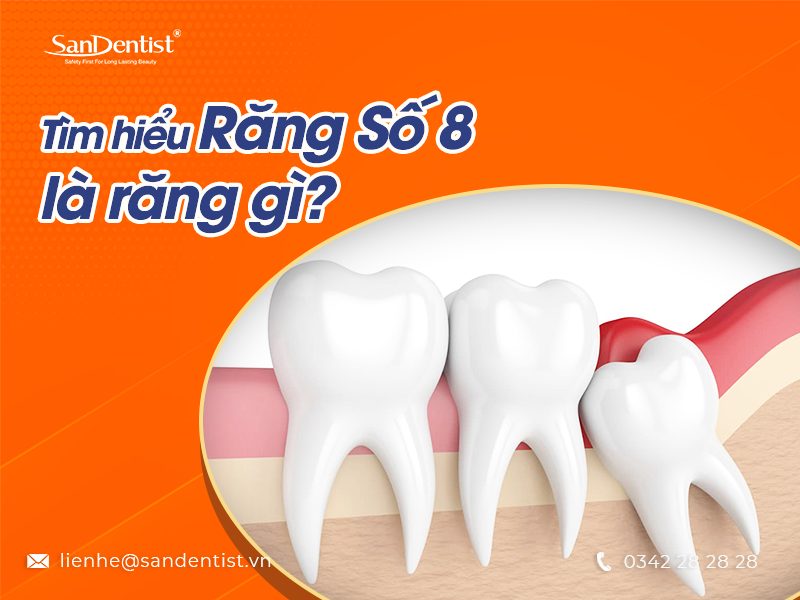 Răng số 8 là răng gì? Răng số 8 gây ra các biến chứng nào?