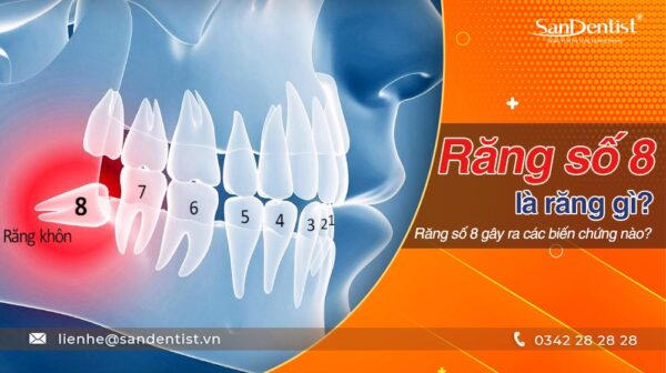 Răng số 8 là răng gì? Răng số 8 gây ra các biến chứng nào?