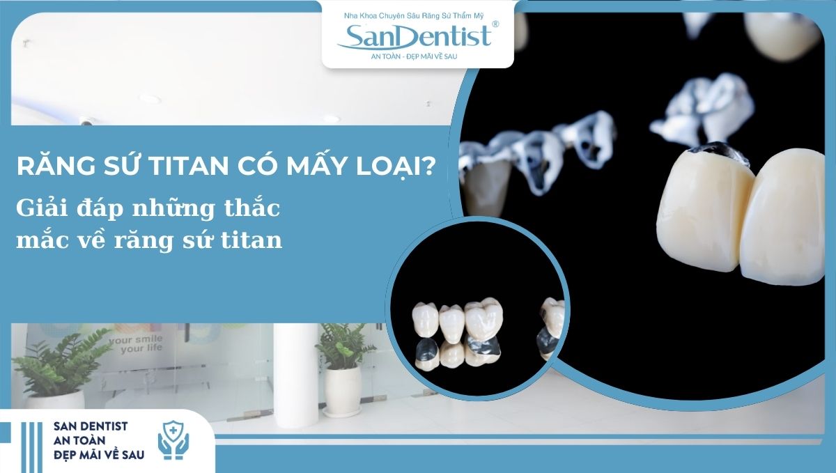 Răng sứ titan có mấy loại_ Giải đáp những thắc mắc về răng sứ titan