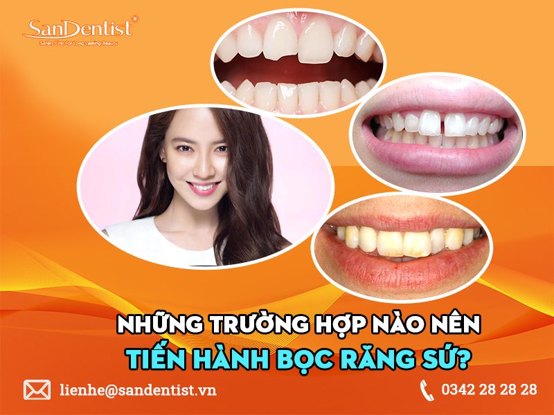 Mài răng bọc sứ có đau không? Những ai nên làm răng sứ?