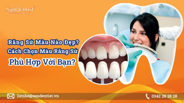 Răng sứ màu nào đẹp? Cách chọn màu răng sứ phù hợp với bạn?