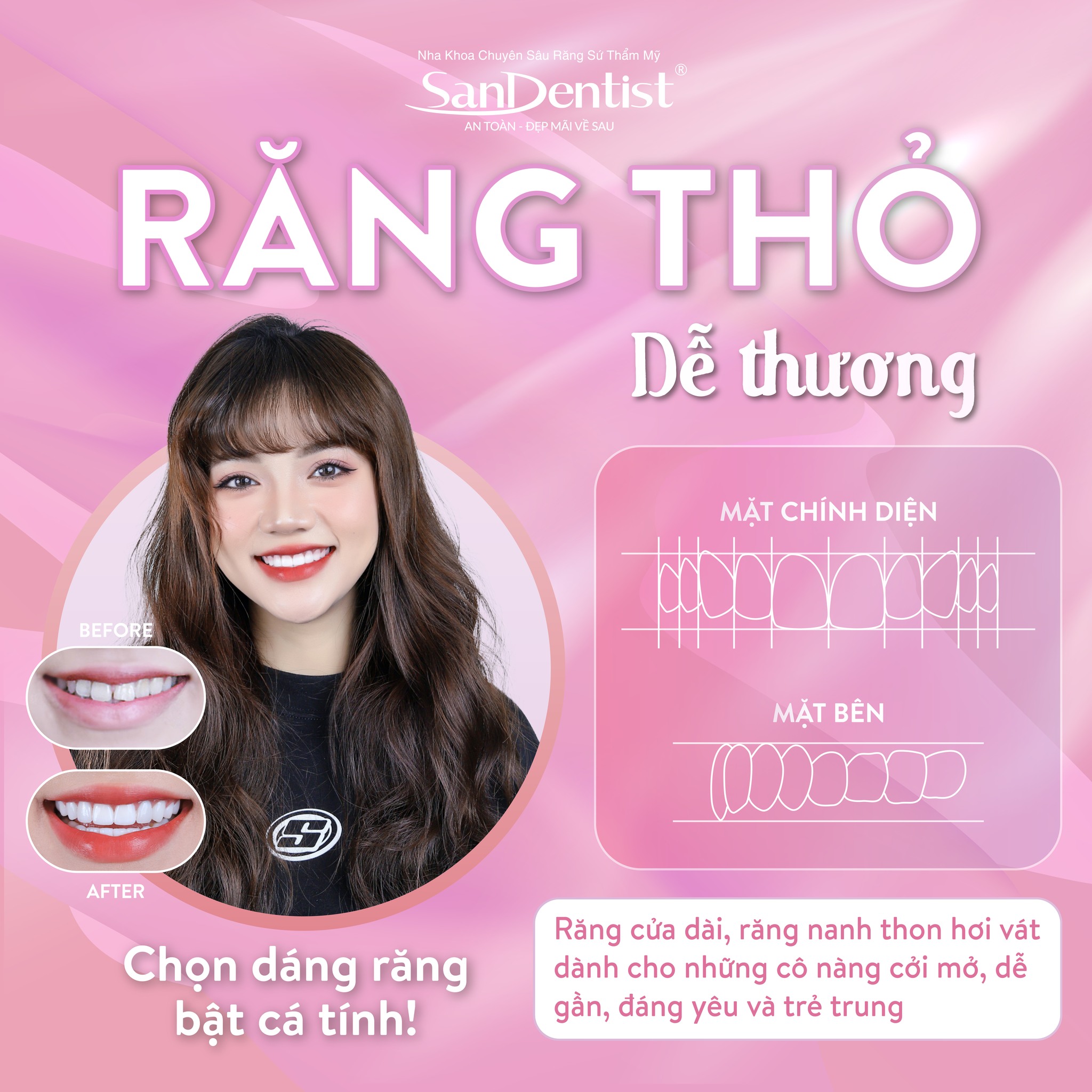 Mẫu dáng răng thỏ dễ thương