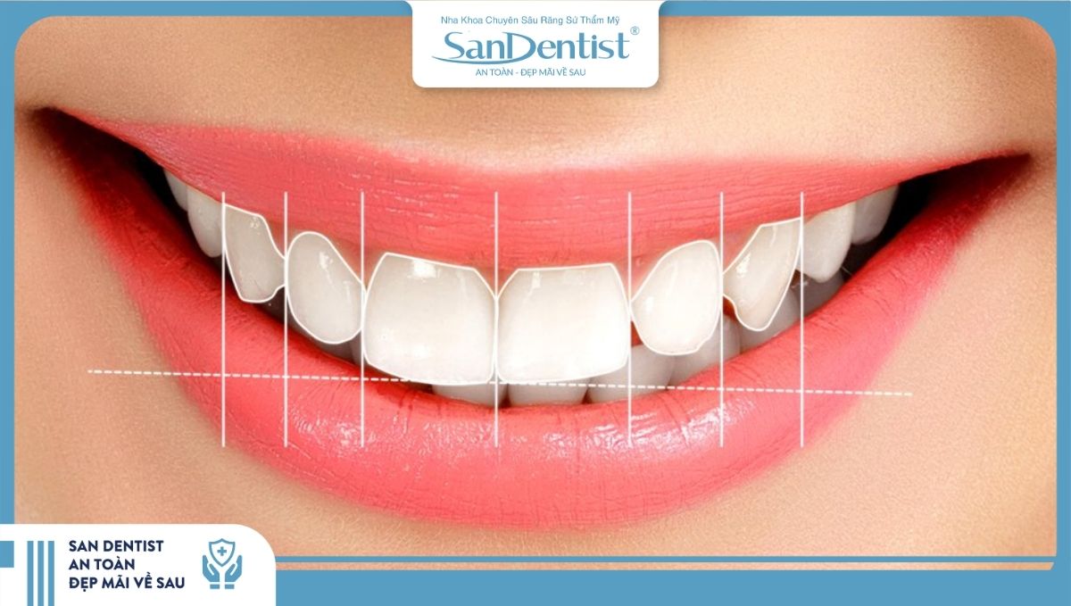 Cách lựa chọn mẫu răng sứ phù hợp với gương mặt