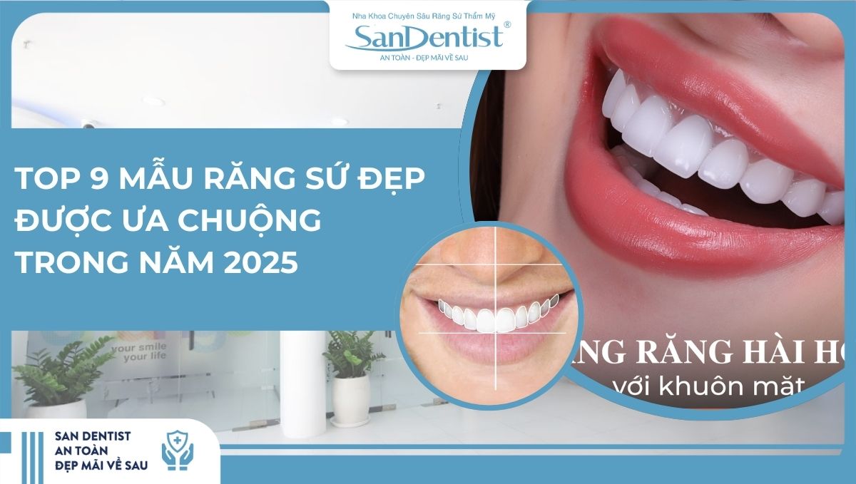 Top 9 mẫu răng sứ đẹp được ưa chuộng trong năm 2025