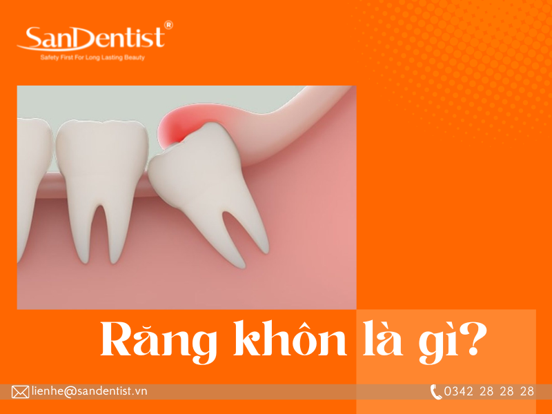 Răng khôn mọc lệch ra má có những nguy hiểm gì?