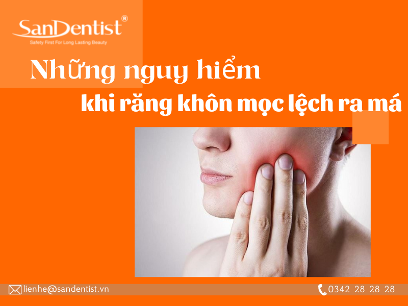 Răng khôn mọc lệch ra má có những nguy hiểm gì?