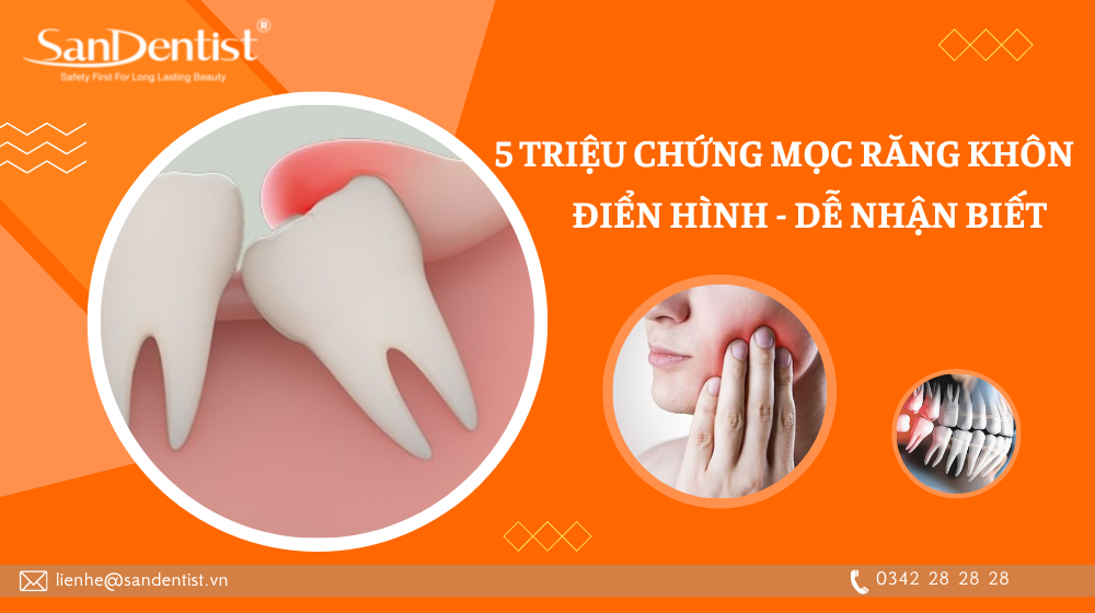 5 triệu chứng mọc răng khôn điển hình dễ nhận biết 
