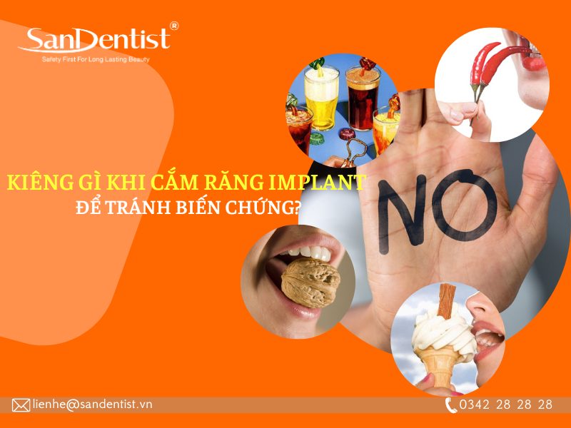 Nên kiêng gì khi cắm răng Implant để tránh các biến chứng?