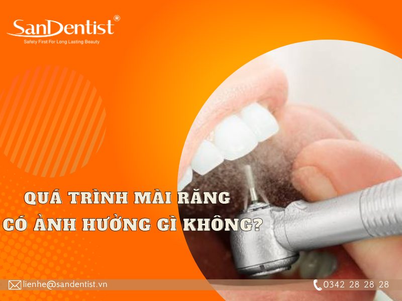 Tìm hiểu mài răng có cần thiết khi bọc sứ hay không?
