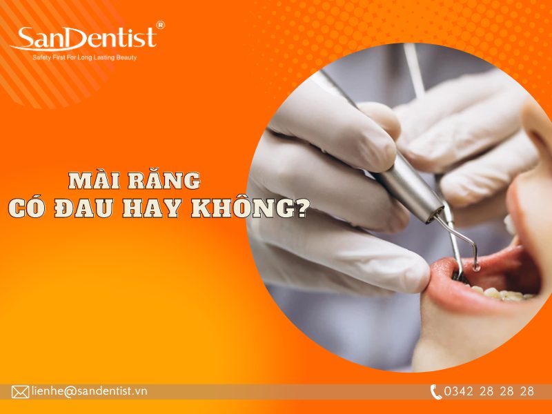 Tìm hiểu mài răng có cần thiết khi bọc sứ hay không?