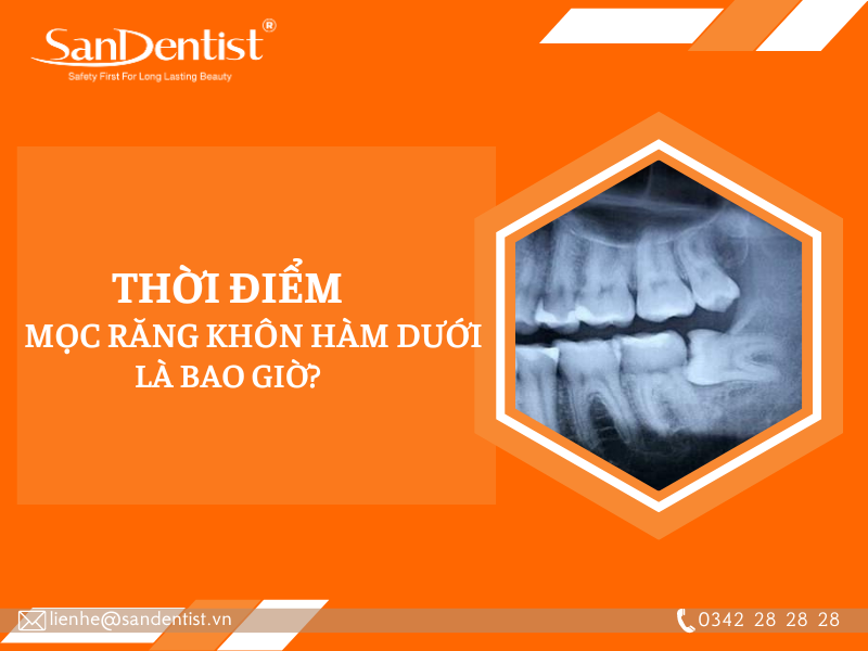 Mọc răng khôn hàm dưới có nên nhổ hay không?
