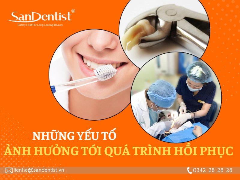 Nhổ răng khôn bao lâu thì lành? Những cách chăm sóc vết thương đúng