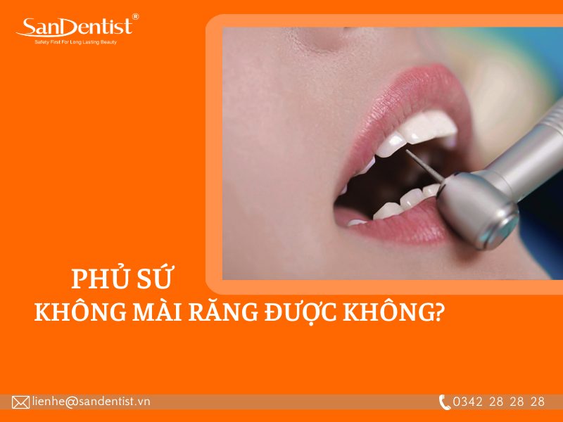 Giải đáp thắc mắc: Phủ sứ không mài răng được không?