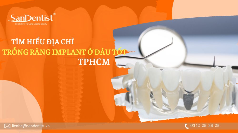 Tìm hiểu địa chỉ trồng răng Implant ở đâu tốt TPHCM