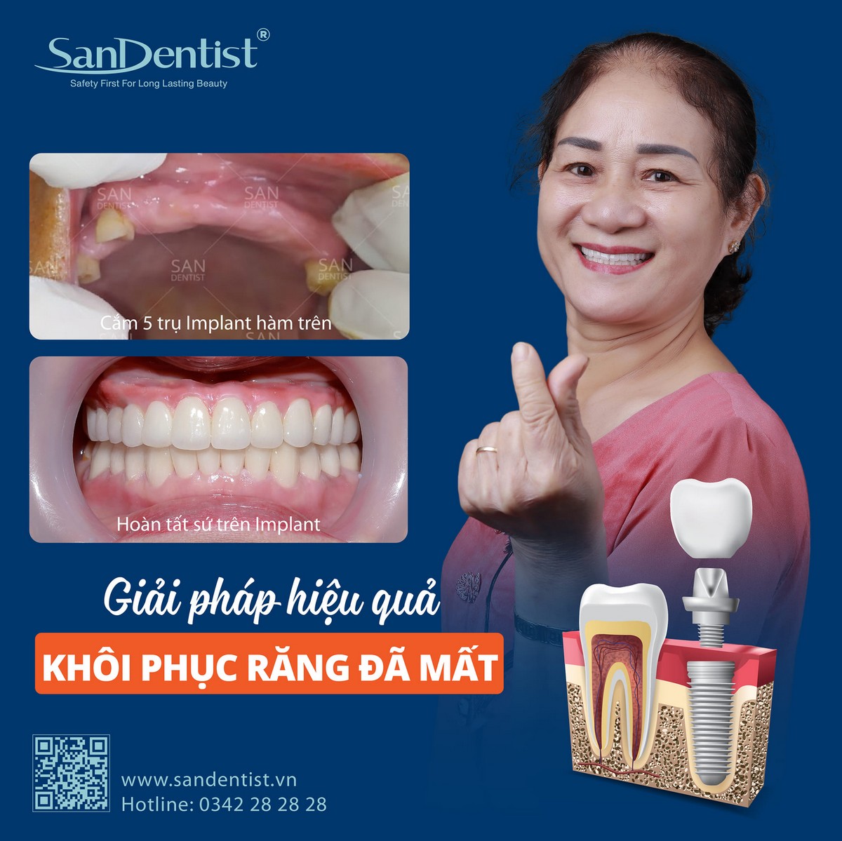 Người lớn tuổi mất răng: Làm sao để cải thiện ăn nhai?