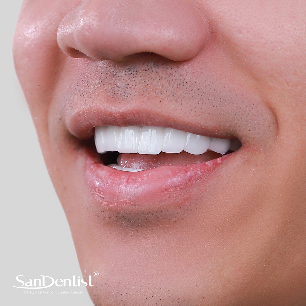 Nhìn dáng răng phong thủy, đoán vận mệnh sang hèn