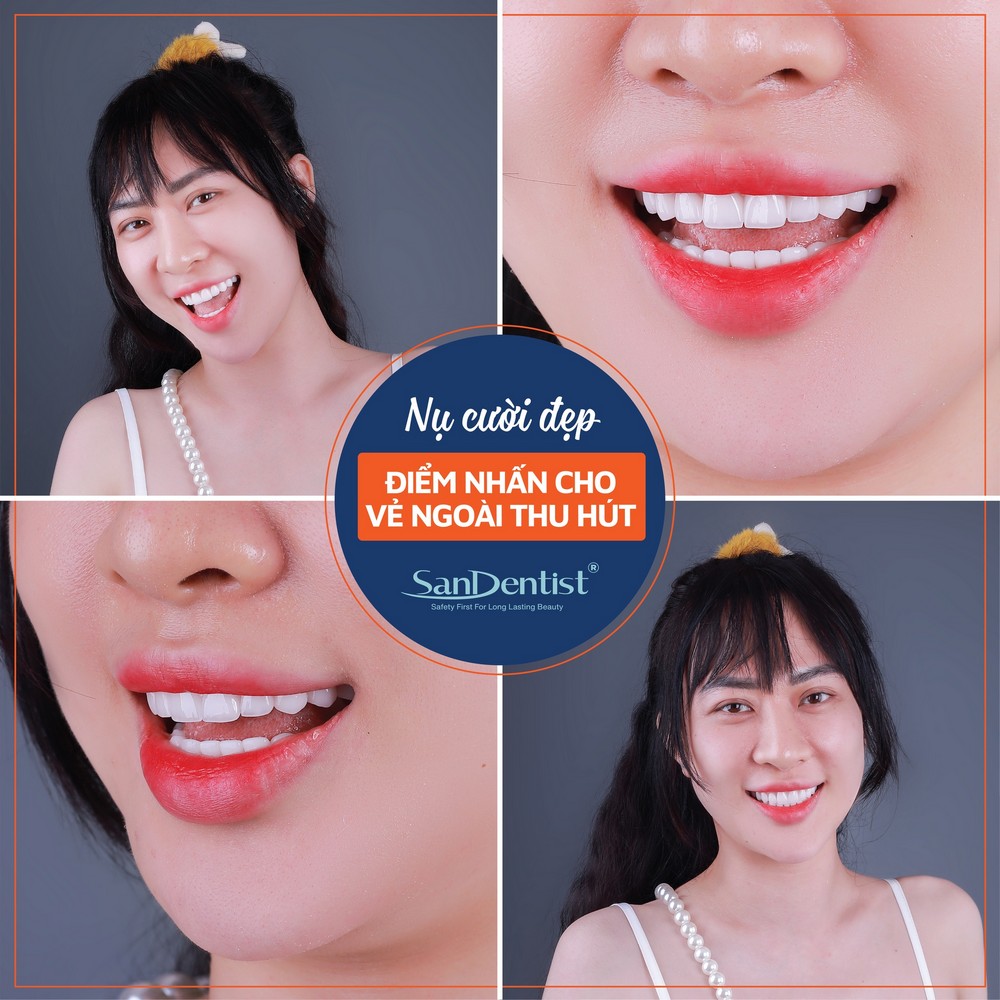 Nhìn dáng răng phong thủy, đoán vận mệnh sang hèn