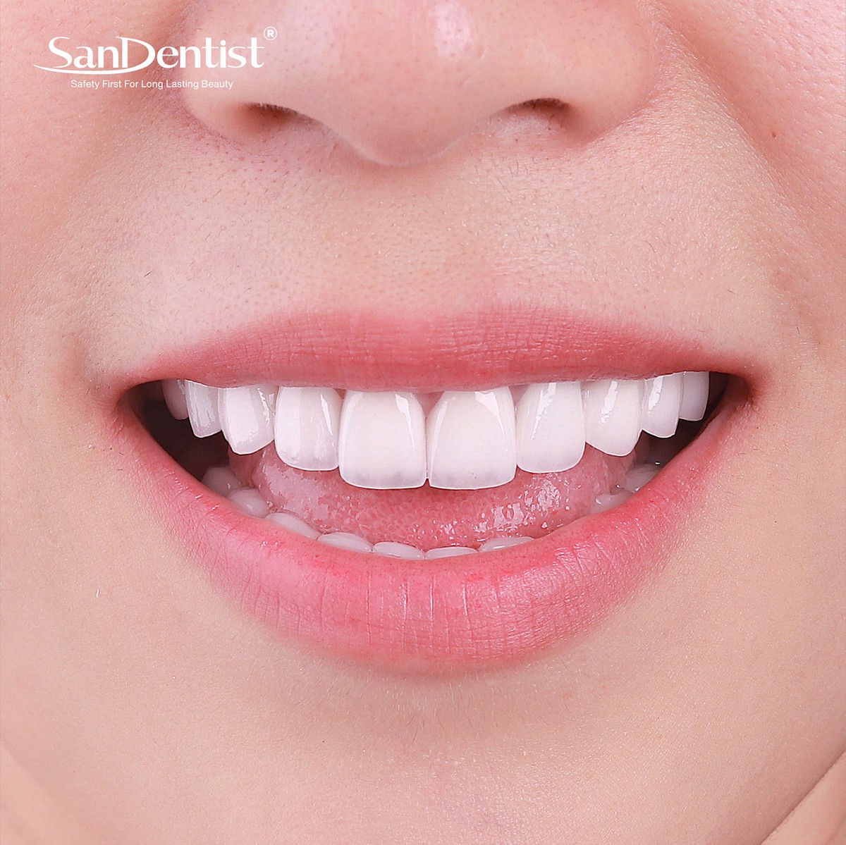 Sốc: Chạy bộ có thể là nguyên nhân gây mòn men răng!