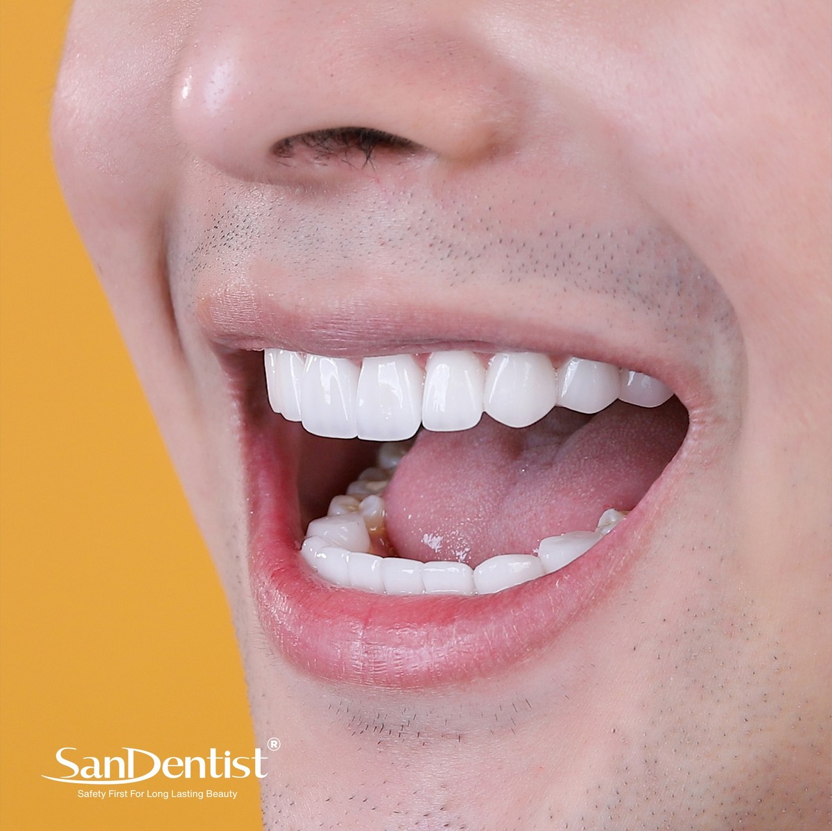 Ngứa nướu răng: Nguyên nhân và các biện pháp điều trị