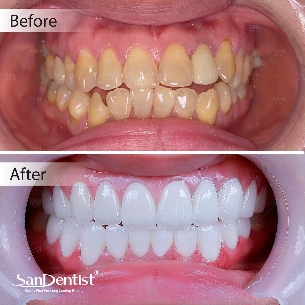 4 sai lầm "chí mạng" khi chăm sóc răng miệng