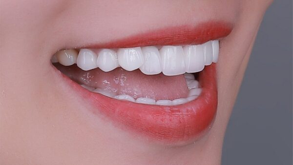 Răng lung lay và biện pháp khắc phục hiệu quả