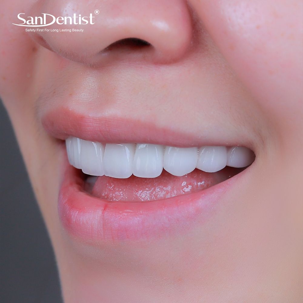 Ăn gì, vệ sinh ra sao để ngăn cao răng tái phát?