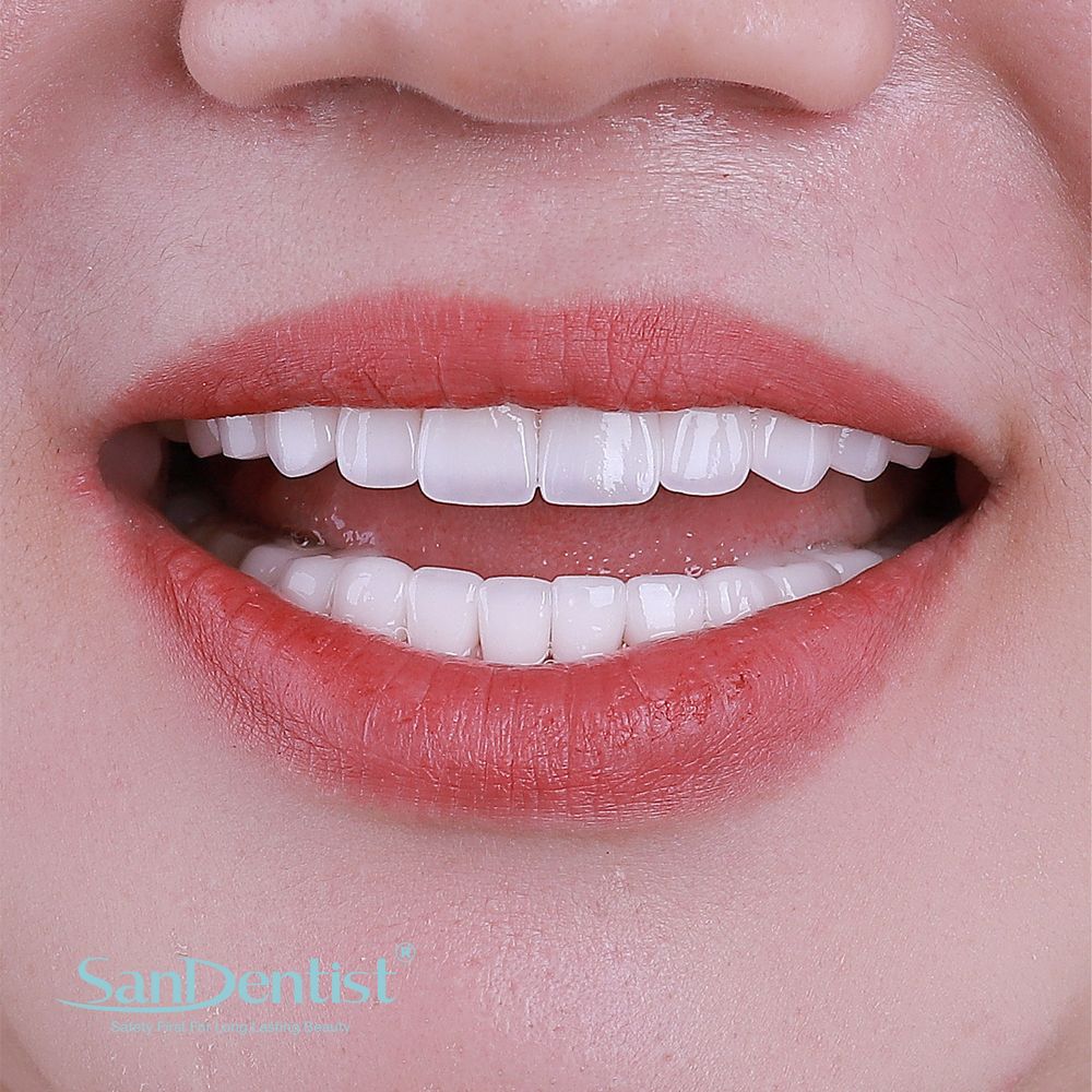 9 bài tập "giải cứu" khi bị viêm khớp thái dương hàm