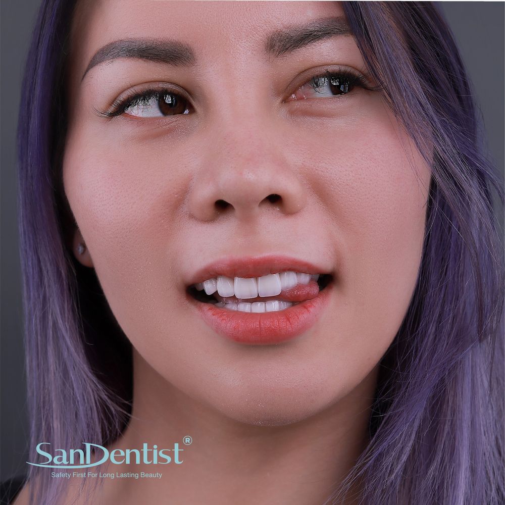 9 bài tập "giải cứu" khi bị viêm khớp thái dương hàm