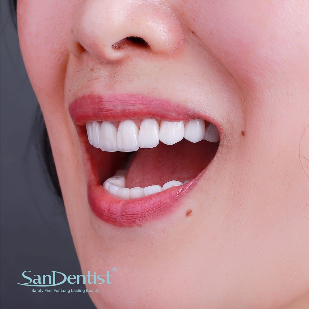 9 bài tập "giải cứu" khi bị viêm khớp thái dương hàm