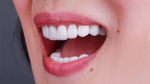 9 bài tập "giải cứu" khi bị viêm khớp thái dương hàm