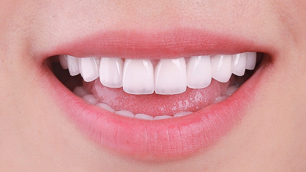 Cạo vôi răng có thực sự giúp răng trắng sáng?