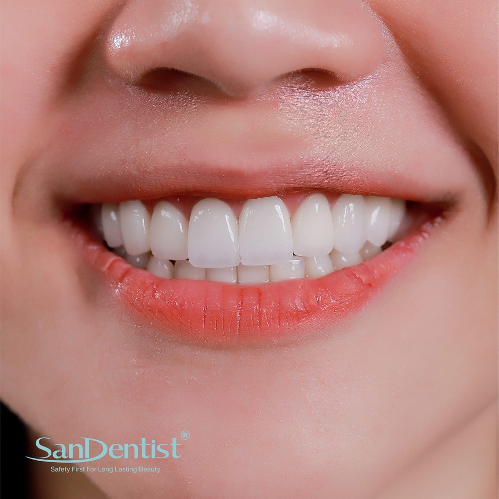 Cấu trúc răng của con người có gì đặc biệt?