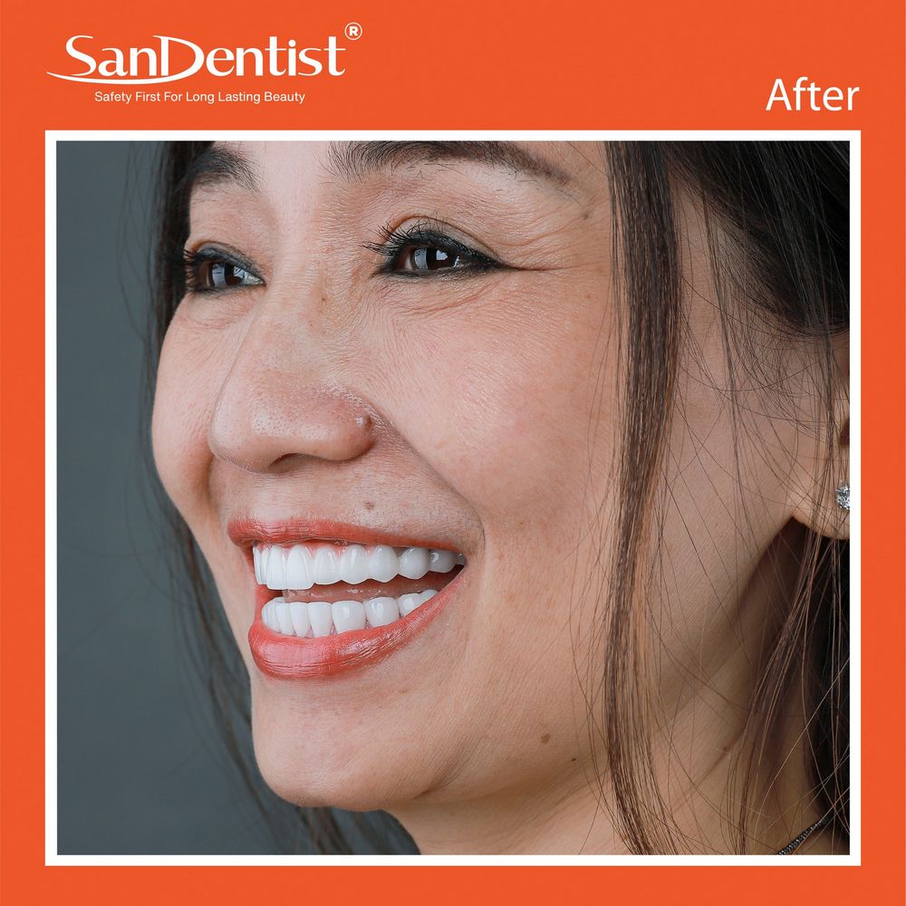 Đau răng ở người già: Nguyên nhân và biện pháp điều trị