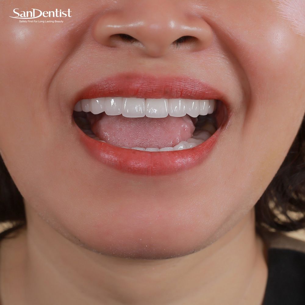 Điều trị viêm khớp thái dương hàm tại nhà như thế nào?