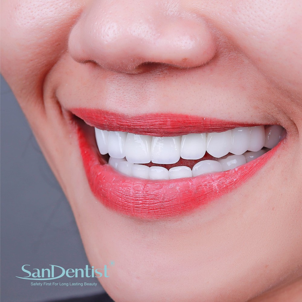 Hàm răng hô ảnh hưởng tới vận mệnh ra sao?