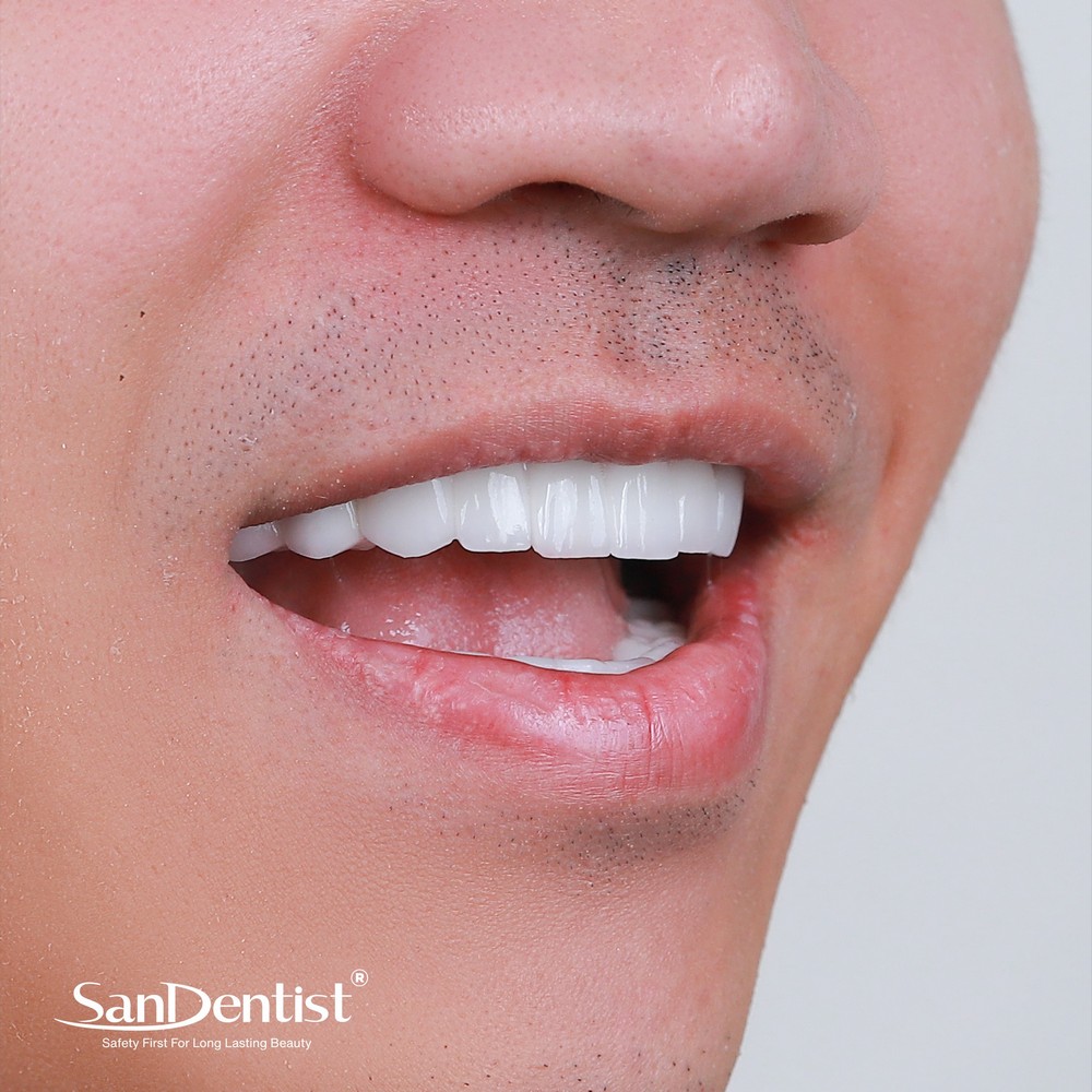 Hàm răng người đàn ông nói lên điều gì về họ?