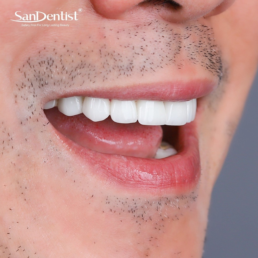 Hàm răng người đàn ông nói lên điều gì về họ?