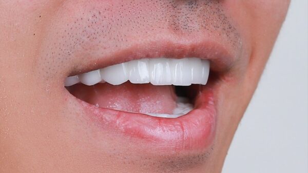 Hàm răng người đàn ông nói lên điều gì về họ?