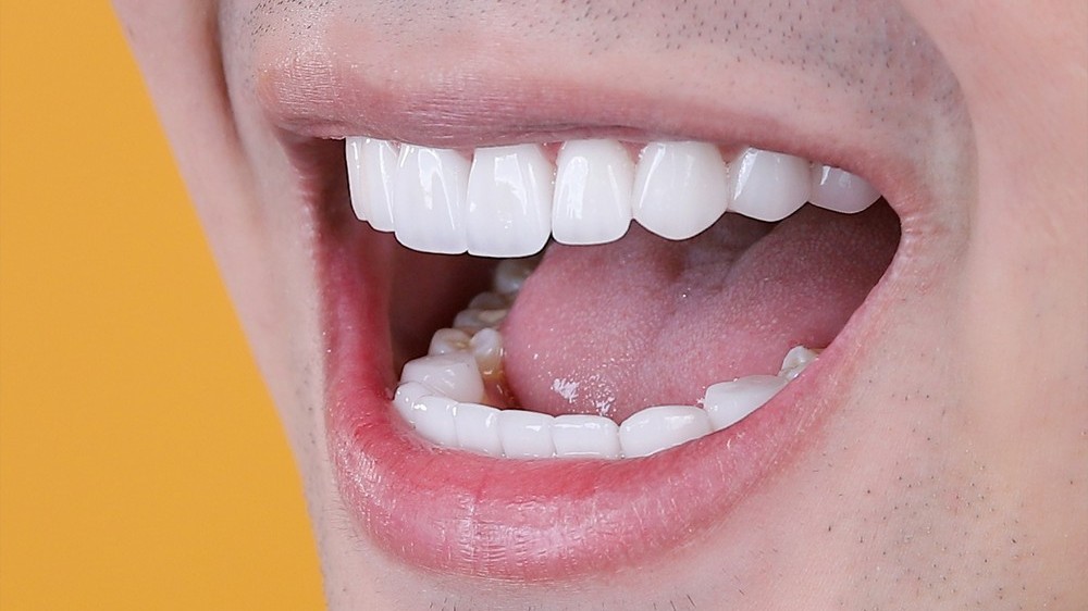 Màu sắc răng nói lên điều gì về tình hình sức khỏe?