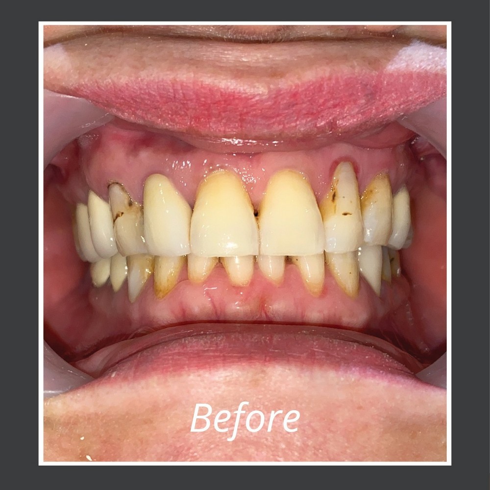 Răng cửa to: Vận mệnh liệu có huy hoàng?