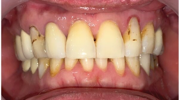 Răng cửa to: Vận mệnh liệu có huy hoàng?