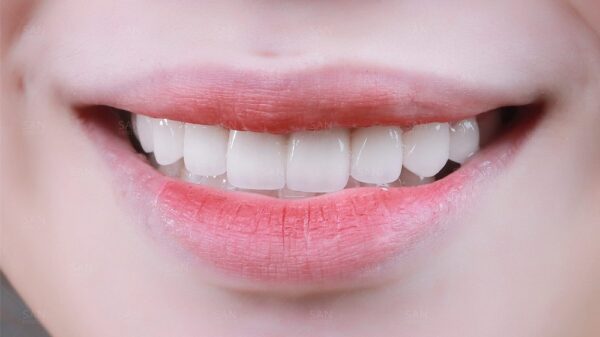 Răng đều như hạt bắp: Tiêu chuẩn thẩm mỹ và phong thủy